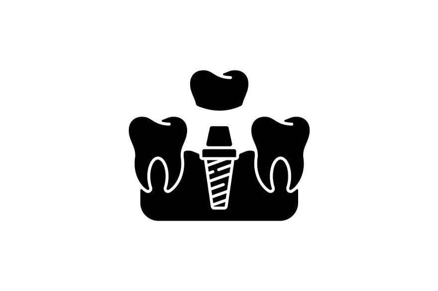Implantologjia
