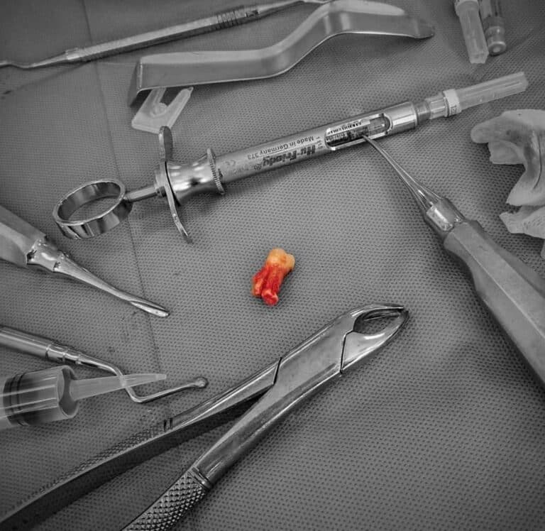 Kirurgjia Orale — Dental Land