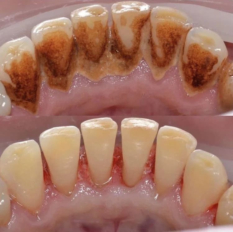 Periodontologjia — Dental Land