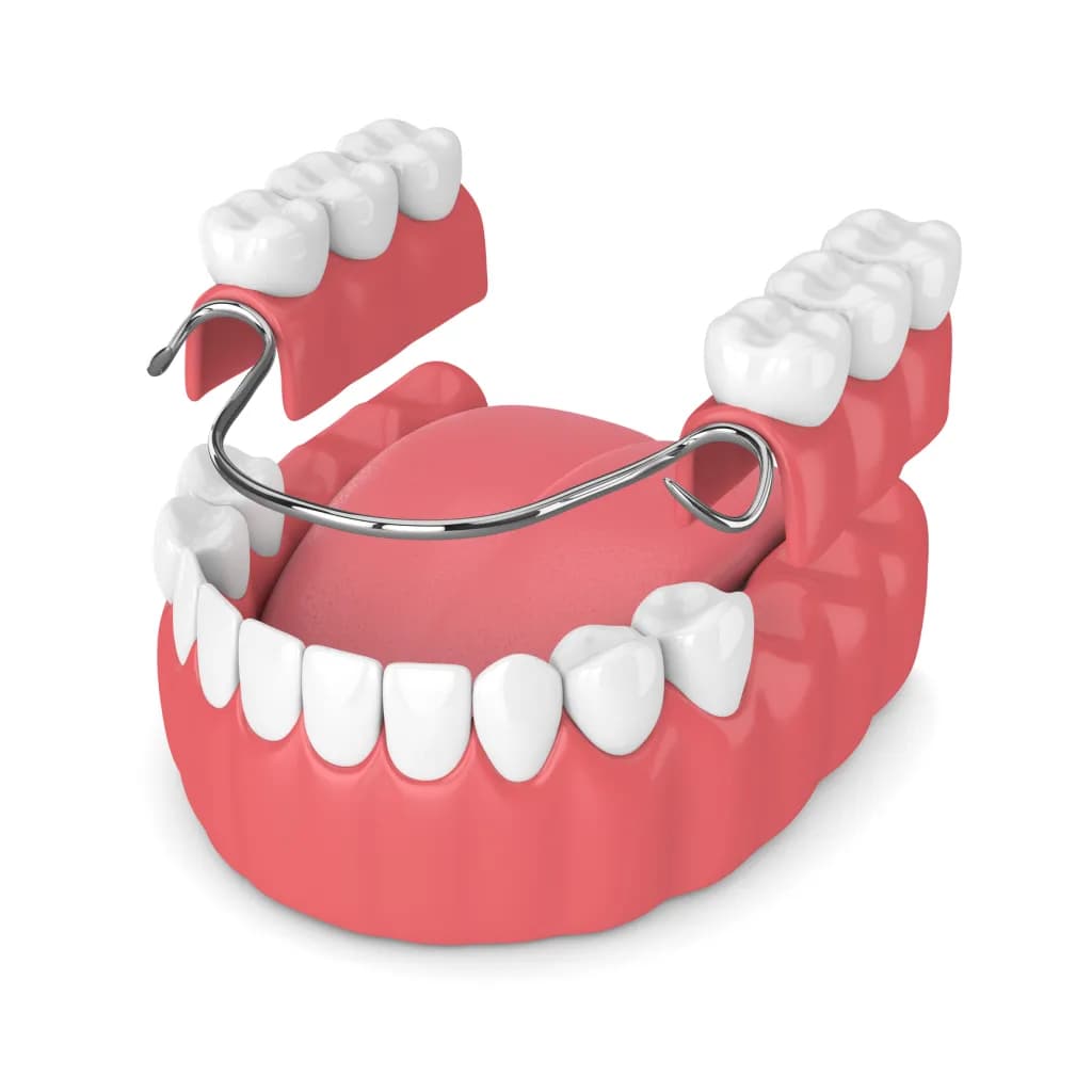 Protezat e Lëvizshme — Dental Land