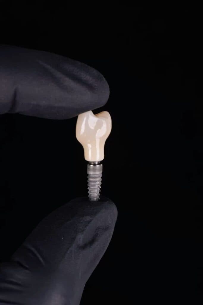 Implantologjia — Dental Land