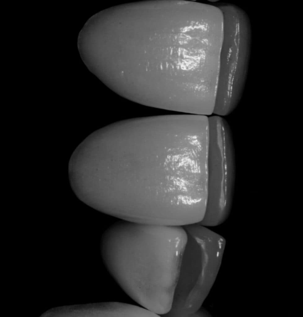 Kurora Dentare — Dental Land