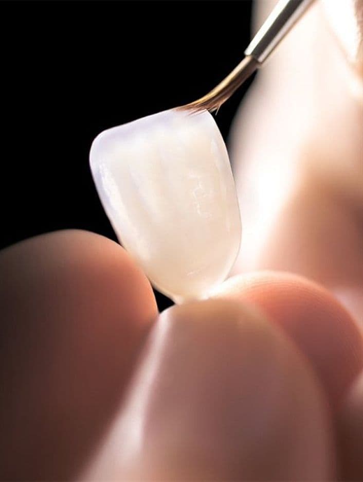 Kurora Dentare — Dental Land