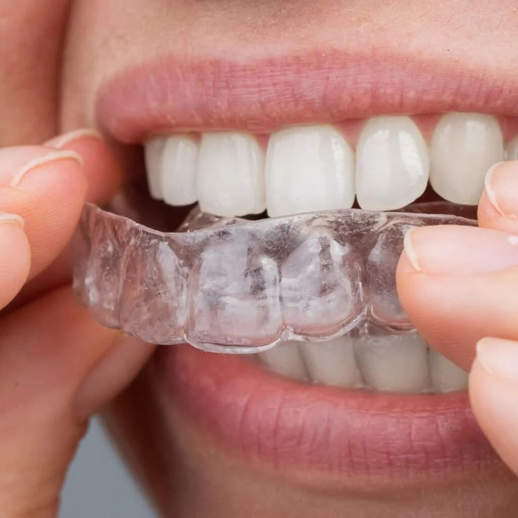 Ortodoncia — Drejtimi i dhëmbëve — Dental Land
