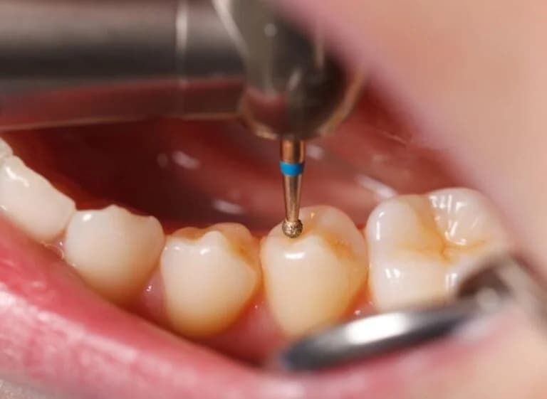 Terapi — Dental Land