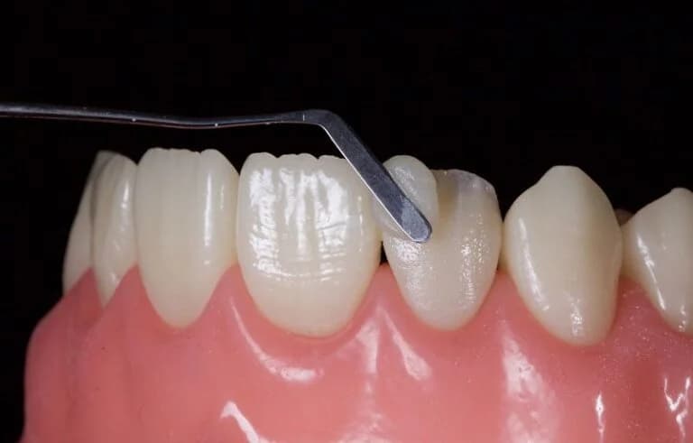 Terapi — Dental Land