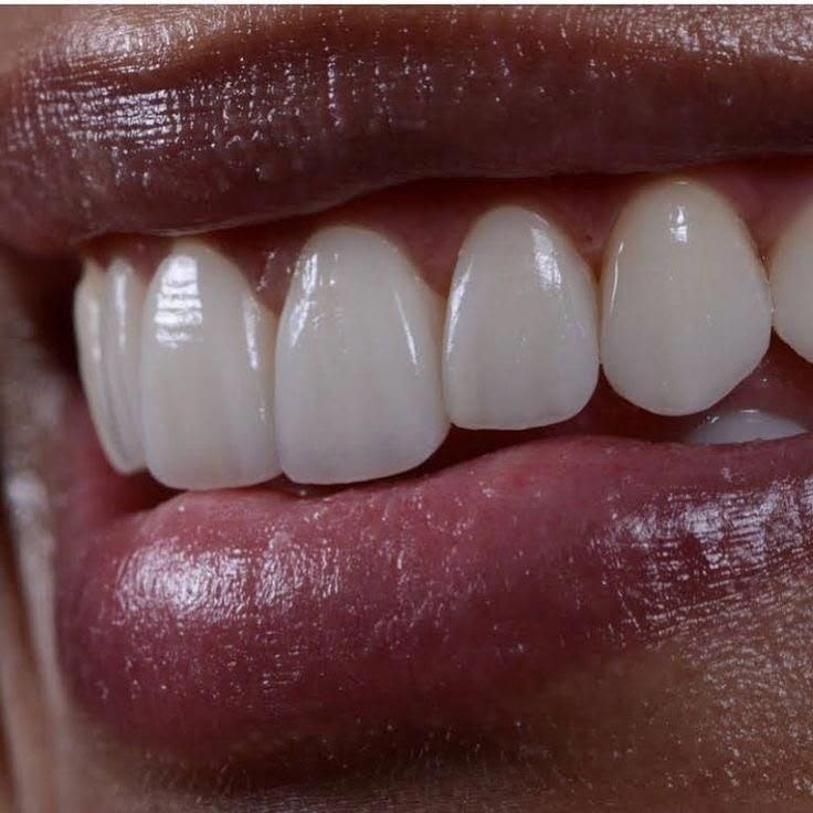 Il tuo nuovo sorriso ti aspetta a Dental Land
